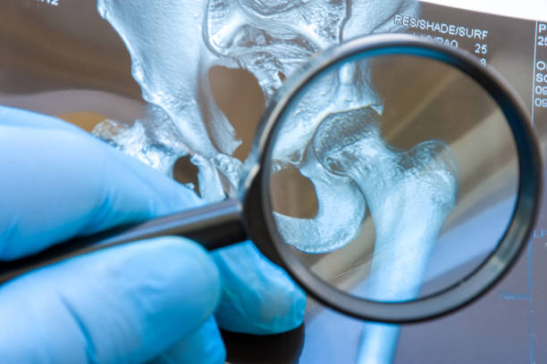 best doctor for hip replacement in nashik