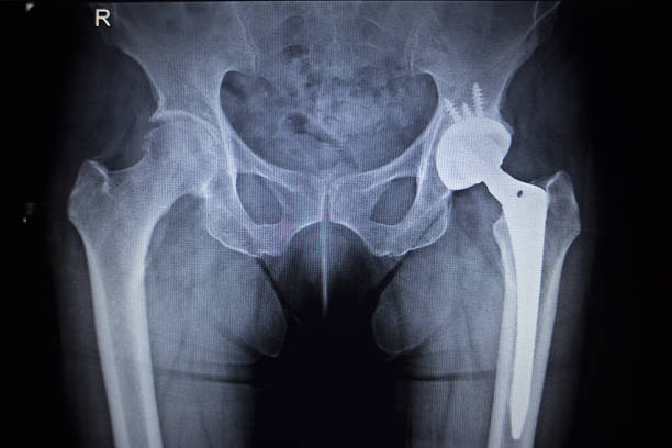 best doctor for joint replacement in nashik